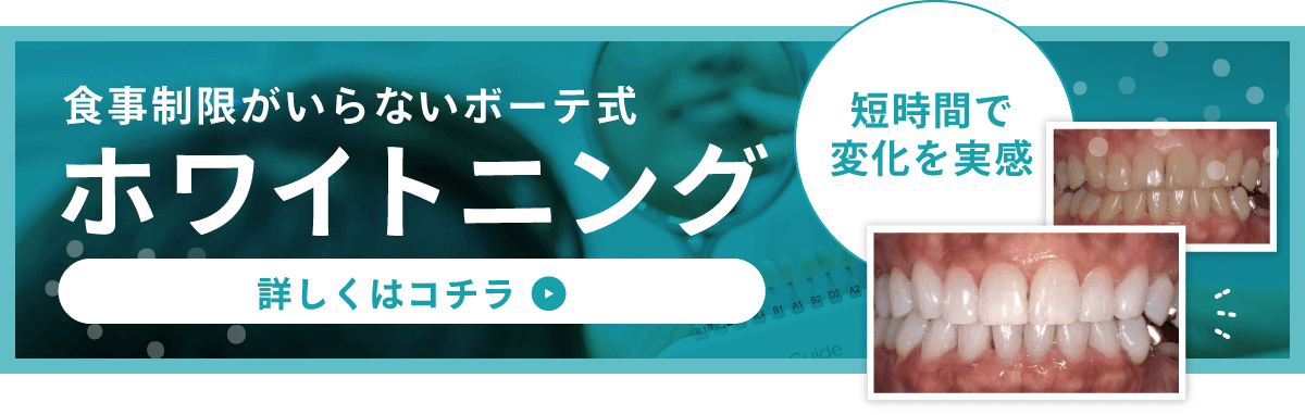 食事制限がいらないボーテ式ホワイトニング
