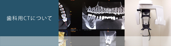 歯科用CTについて