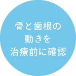 骨と歯根の動きを治療前に確認